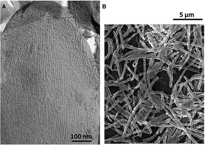 The intriguing strategies of Tannerella forsythia's host interaction